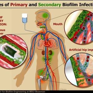 cbe03_1n2infect.jpg